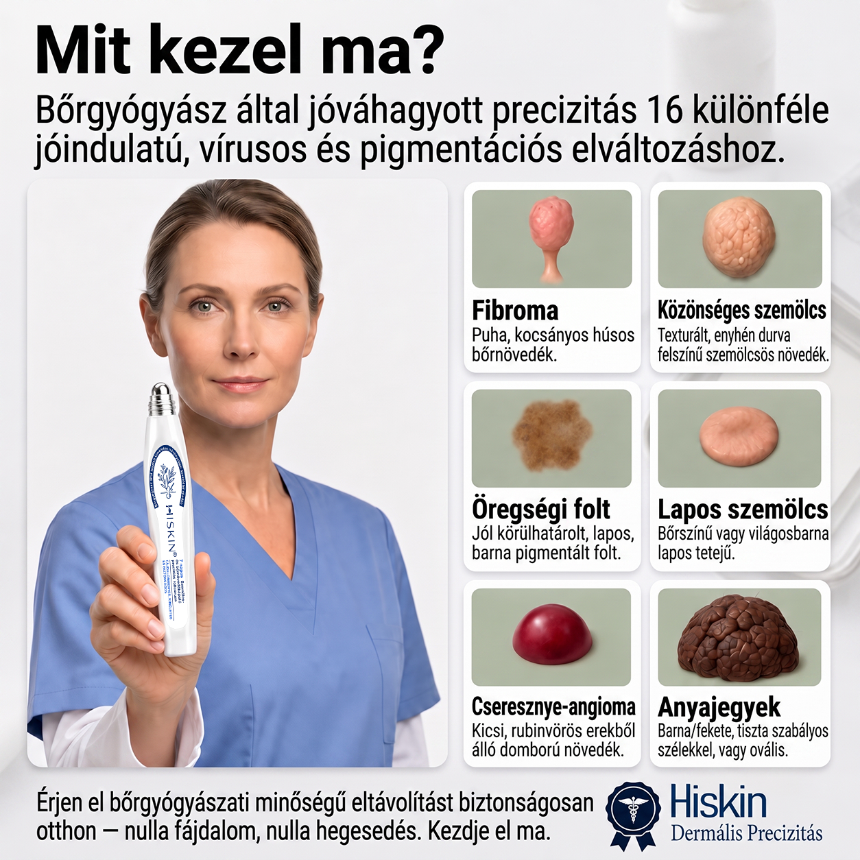 Hivatalos Márkabolt | 💓 Hiskin® 7 napos Szemölcseltávolító Roll-on Ápoló Folyadék (Fájdalommentes rollerball technológia, hegek nélkül) 🐬