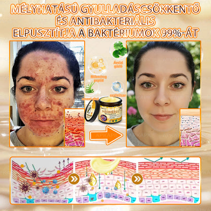 💜APKAPK® 𝐌É𝐇𝐌É𝐑𝐄𝐆 Á𝐓𝐅𝐎𝐆Ó 𝐊𝐑É𝐌𝐀 💛bőrnövedékek 𝐤𝐞𝐳𝐞𝐥é𝐬𝐞 𝐦𝐚𝐠á𝐛𝐚𝐧 𝐟𝐨𝐠𝐥𝐚𝐥𝐣𝐚: é𝐥𝐞𝐭𝐤𝐨𝐫𝐢 𝐟𝐨𝐥𝐭𝐨𝐤, 𝐡𝐞𝐠𝐞𝐤, 𝐬𝐳𝐞𝐦ö𝐥𝐜𝐬ö𝐤, 𝐛ö𝐫𝐧ö𝐯𝐞𝐝é𝐤𝐞𝐤, 𝐭á𝐥𝐲𝐨𝐠𝐨𝐤, 𝐩𝐚𝐭𝐭𝐚𝐧á𝐬𝐨𝐤, 𝐞𝐤𝐜é𝐦𝐚, 𝐩𝐬𝐨𝐫𝐢𝐚𝐬𝐢𝐬, 𝐚𝐜𝐧𝐞 𝐢𝐧𝐯𝐞𝐫𝐬𝐚, 𝐫á𝐧𝐜𝐨𝐤, 𝐛ö𝐫ö𝐫𝐞𝐠𝐞𝐝é𝐬 é𝐬 𝐞𝐠𝐲é𝐛 𝐩𝐫𝐨𝐛𝐥é𝐦á𝐤🔥