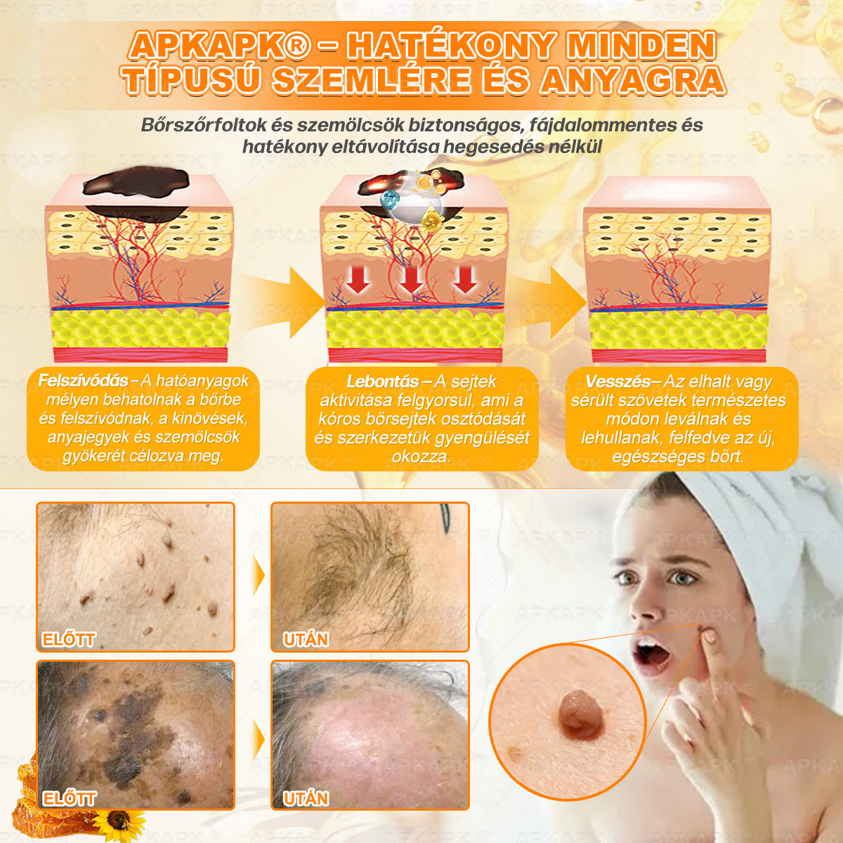 💜APKAPK® 𝐌É𝐇𝐌É𝐑𝐄𝐆 Á𝐓𝐅𝐎𝐆Ó 𝐊𝐑É𝐌𝐀 💛bőrnövedékek 𝐤𝐞𝐳𝐞𝐥é𝐬𝐞 𝐦𝐚𝐠á𝐛𝐚𝐧 𝐟𝐨𝐠𝐥𝐚𝐥𝐣𝐚: é𝐥𝐞𝐭𝐤𝐨𝐫𝐢 𝐟𝐨𝐥𝐭𝐨𝐤, 𝐡𝐞𝐠𝐞𝐤, 𝐬𝐳𝐞𝐦ö𝐥𝐜𝐬ö𝐤, 𝐛ö𝐫𝐧ö𝐯𝐞𝐝é𝐤𝐞𝐤, 𝐭á𝐥𝐲𝐨𝐠𝐨𝐤, 𝐩𝐚𝐭𝐭𝐚𝐧á𝐬𝐨𝐤, 𝐞𝐤𝐜é𝐦𝐚, 𝐩𝐬𝐨𝐫𝐢𝐚𝐬𝐢𝐬, 𝐚𝐜𝐧𝐞 𝐢𝐧𝐯𝐞𝐫𝐬𝐚, 𝐫á𝐧𝐜𝐨𝐤, 𝐛ö𝐫ö𝐫𝐞𝐠𝐞𝐝é𝐬 é𝐬 𝐞𝐠𝐲é𝐛 𝐩𝐫𝐨𝐛𝐥é𝐦á𝐤🔥