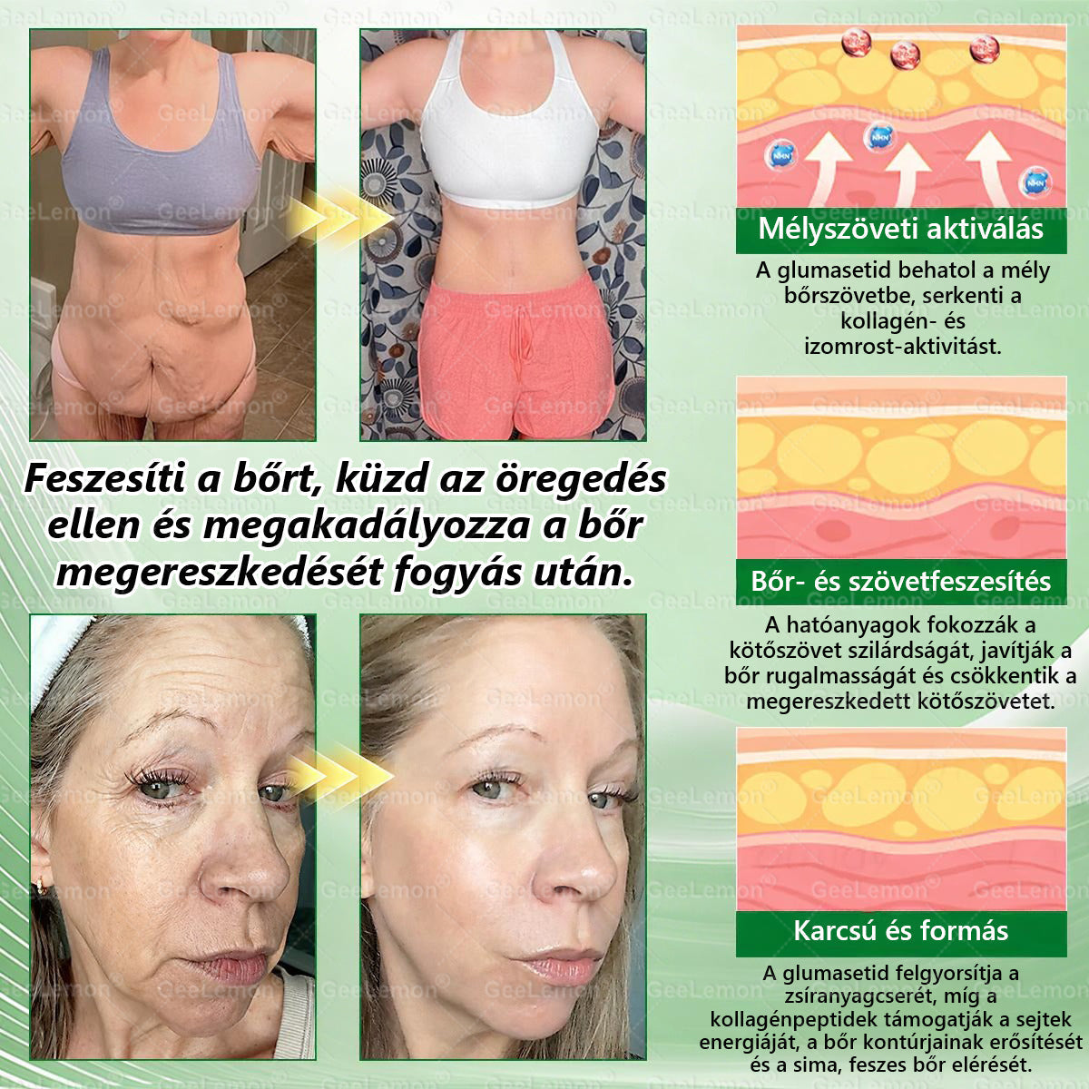 𝐆𝐞𝑒𝐿𝑒𝐦𝐨𝐧® 👩‍⚕️❤️ Glumasetide 15 az 1-ben Karcsú és Egészséges Nano Mikrotűs Tapasz