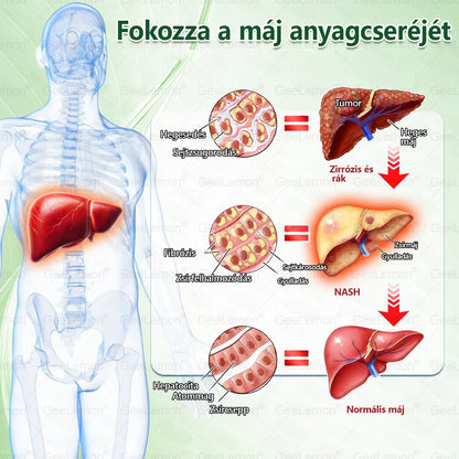 𝐆𝐞𝑒𝐿𝑒𝐦𝐨𝐧® 👩‍⚕️❤️ Glumasetide 15 az 1-ben Karcsú és Egészséges Nano Mikrotűs Tapasz