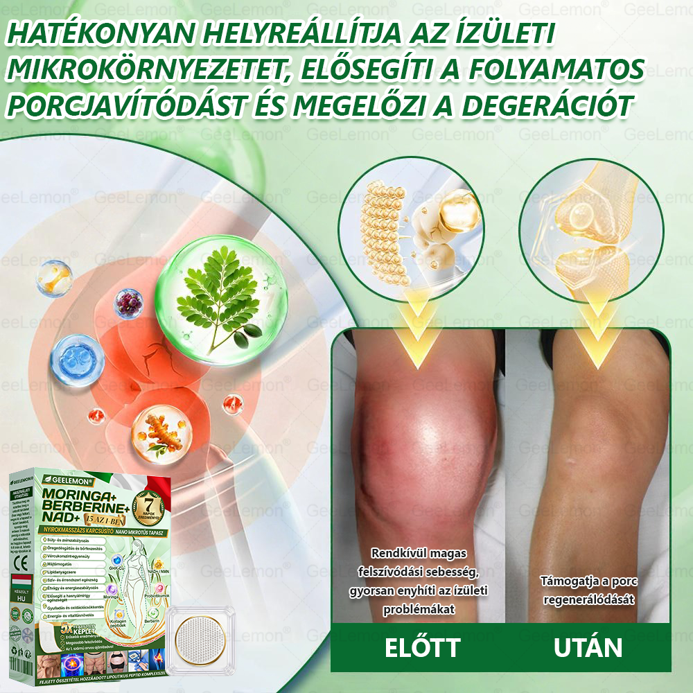 𝐆𝐞𝑒𝐿𝑒𝐦𝐨𝐧® 👩‍⚕️❤️ Glumasetide 15 az 1-ben Karcsú és Egészséges Nano Mikrotűs Tapasz