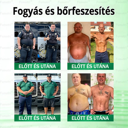 Magyar szakértők által ajánlott · Hivatalos Bolt 💘Funutri® 10 az 1-ben anyagcsere-támogató karcsúsító nano mikro-tűs tapasz