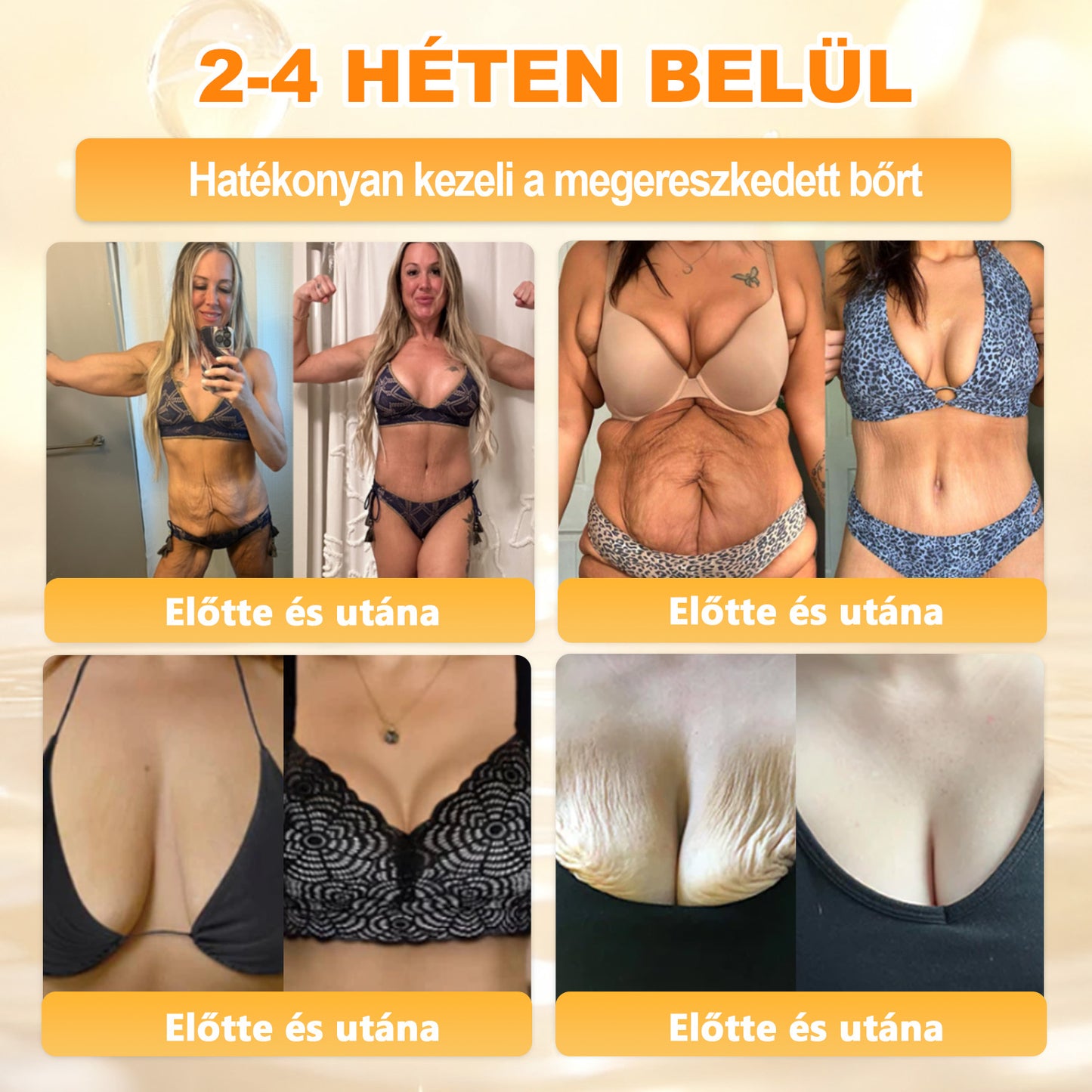 💜APKAPK® 𝐌É𝐇𝐌É𝐑𝐄𝐆 Á𝐓𝐅𝐎𝐆Ó 𝐊𝐑É𝐌𝐀 💛bőrnövedékek 𝐤𝐞𝐳𝐞𝐥é𝐬𝐞 𝐦𝐚𝐠á𝐛𝐚𝐧 𝐟𝐨𝐠𝐥𝐚𝐥𝐣𝐚: é𝐥𝐞𝐭𝐤𝐨𝐫𝐢 𝐟𝐨𝐥𝐭𝐨𝐤, 𝐡𝐞𝐠𝐞𝐤, 𝐬𝐳𝐞𝐦ö𝐥𝐜𝐬ö𝐤, 𝐛ö𝐫𝐧ö𝐯𝐞𝐝é𝐤𝐞𝐤, 𝐭á𝐥𝐲𝐨𝐠𝐨𝐤, 𝐩𝐚𝐭𝐭𝐚𝐧á𝐬𝐨𝐤, 𝐞𝐤𝐜é𝐦𝐚, 𝐩𝐬𝐨𝐫𝐢𝐚𝐬𝐢𝐬, 𝐚𝐜𝐧𝐞 𝐢𝐧𝐯𝐞𝐫𝐬𝐚, 𝐫á𝐧𝐜𝐨𝐤, 𝐛ö𝐫ö𝐫𝐞𝐠𝐞𝐝é𝐬 é𝐬 𝐞𝐠𝐲é𝐛 𝐩𝐫𝐨𝐛𝐥é𝐦á𝐤🔥