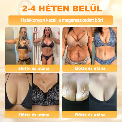 💜APKAPK® 𝐌É𝐇𝐌É𝐑𝐄𝐆 Á𝐓𝐅𝐎𝐆Ó 𝐊𝐑É𝐌𝐀 💛bőrnövedékek 𝐤𝐞𝐳𝐞𝐥é𝐬𝐞 𝐦𝐚𝐠á𝐛𝐚𝐧 𝐟𝐨𝐠𝐥𝐚𝐥𝐣𝐚: é𝐥𝐞𝐭𝐤𝐨𝐫𝐢 𝐟𝐨𝐥𝐭𝐨𝐤, 𝐡𝐞𝐠𝐞𝐤, 𝐬𝐳𝐞𝐦ö𝐥𝐜𝐬ö𝐤, 𝐛ö𝐫𝐧ö𝐯𝐞𝐝é𝐤𝐞𝐤, 𝐭á𝐥𝐲𝐨𝐠𝐨𝐤, 𝐩𝐚𝐭𝐭𝐚𝐧á𝐬𝐨𝐤, 𝐞𝐤𝐜é𝐦𝐚, 𝐩𝐬𝐨𝐫𝐢𝐚𝐬𝐢𝐬, 𝐚𝐜𝐧𝐞 𝐢𝐧𝐯𝐞𝐫𝐬𝐚, 𝐫á𝐧𝐜𝐨𝐤, 𝐛ö𝐫ö𝐫𝐞𝐠𝐞𝐝é𝐬 é𝐬 𝐞𝐠𝐲é𝐛 𝐩𝐫𝐨𝐛𝐥é𝐦á𝐤🔥