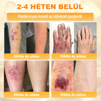 💜APKAPK® 𝐌É𝐇𝐌É𝐑𝐄𝐆 Á𝐓𝐅𝐎𝐆Ó 𝐊𝐑É𝐌𝐀 💛bőrnövedékek 𝐤𝐞𝐳𝐞𝐥é𝐬𝐞 𝐦𝐚𝐠á𝐛𝐚𝐧 𝐟𝐨𝐠𝐥𝐚𝐥𝐣𝐚: é𝐥𝐞𝐭𝐤𝐨𝐫𝐢 𝐟𝐨𝐥𝐭𝐨𝐤, 𝐡𝐞𝐠𝐞𝐤, 𝐬𝐳𝐞𝐦ö𝐥𝐜𝐬ö𝐤, 𝐛ö𝐫𝐧ö𝐯𝐞𝐝é𝐤𝐞𝐤, 𝐭á𝐥𝐲𝐨𝐠𝐨𝐤, 𝐩𝐚𝐭𝐭𝐚𝐧á𝐬𝐨𝐤, 𝐞𝐤𝐜é𝐦𝐚, 𝐩𝐬𝐨𝐫𝐢𝐚𝐬𝐢𝐬, 𝐚𝐜𝐧𝐞 𝐢𝐧𝐯𝐞𝐫𝐬𝐚, 𝐫á𝐧𝐜𝐨𝐤, 𝐛ö𝐫ö𝐫𝐞𝐠𝐞𝐝é𝐬 é𝐬 𝐞𝐠𝐲é𝐛 𝐩𝐫𝐨𝐛𝐥é𝐦á𝐤🔥