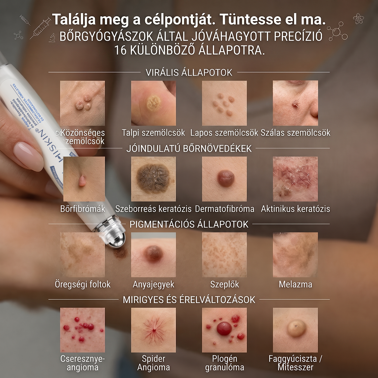 Hivatalos Márkabolt | 💓 Hiskin® 7 napos Szemölcseltávolító Roll-on Ápoló Folyadék (Fájdalommentes rollerball technológia, hegek nélkül) 🐬
