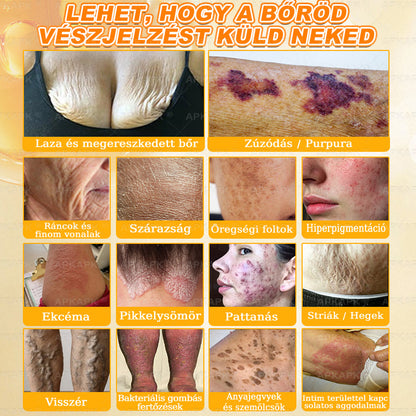 💜APKAPK® 𝐌É𝐇𝐌É𝐑𝐄𝐆 Á𝐓𝐅𝐎𝐆Ó 𝐊𝐑É𝐌𝐀 💛bőrnövedékek 𝐤𝐞𝐳𝐞𝐥é𝐬𝐞 𝐦𝐚𝐠á𝐛𝐚𝐧 𝐟𝐨𝐠𝐥𝐚𝐥𝐣𝐚: é𝐥𝐞𝐭𝐤𝐨𝐫𝐢 𝐟𝐨𝐥𝐭𝐨𝐤, 𝐡𝐞𝐠𝐞𝐤, 𝐬𝐳𝐞𝐦ö𝐥𝐜𝐬ö𝐤, 𝐛ö𝐫𝐧ö𝐯𝐞𝐝é𝐤𝐞𝐤, 𝐭á𝐥𝐲𝐨𝐠𝐨𝐤, 𝐩𝐚𝐭𝐭𝐚𝐧á𝐬𝐨𝐤, 𝐞𝐤𝐜é𝐦𝐚, 𝐩𝐬𝐨𝐫𝐢𝐚𝐬𝐢𝐬, 𝐚𝐜𝐧𝐞 𝐢𝐧𝐯𝐞𝐫𝐬𝐚, 𝐫á𝐧𝐜𝐨𝐤, 𝐛ö𝐫ö𝐫𝐞𝐠𝐞𝐝é𝐬 é𝐬 𝐞𝐠𝐲é𝐛 𝐩𝐫𝐨𝐛𝐥é𝐦á𝐤🔥