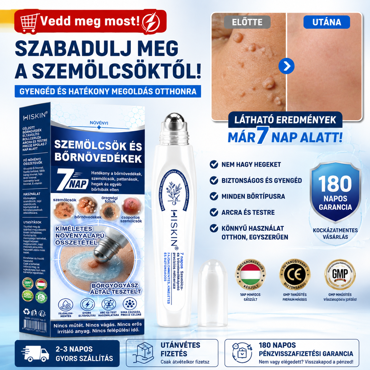 Hivatalos Márkabolt | 🌲 Hiskin® 7 napos Szemölcseltávolító Roll-on Ápoló Folyadék (Fájdalommentes rollerball technológia, hegek nélkül) 🐬