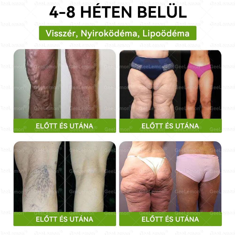 𝐆𝐞𝑒𝐿𝑒𝐦𝐨𝐧® 👩‍⚕️❤️ Glumasetide 15 az 1-ben Karcsú és Egészséges Nano Mikrotűs Tapasz