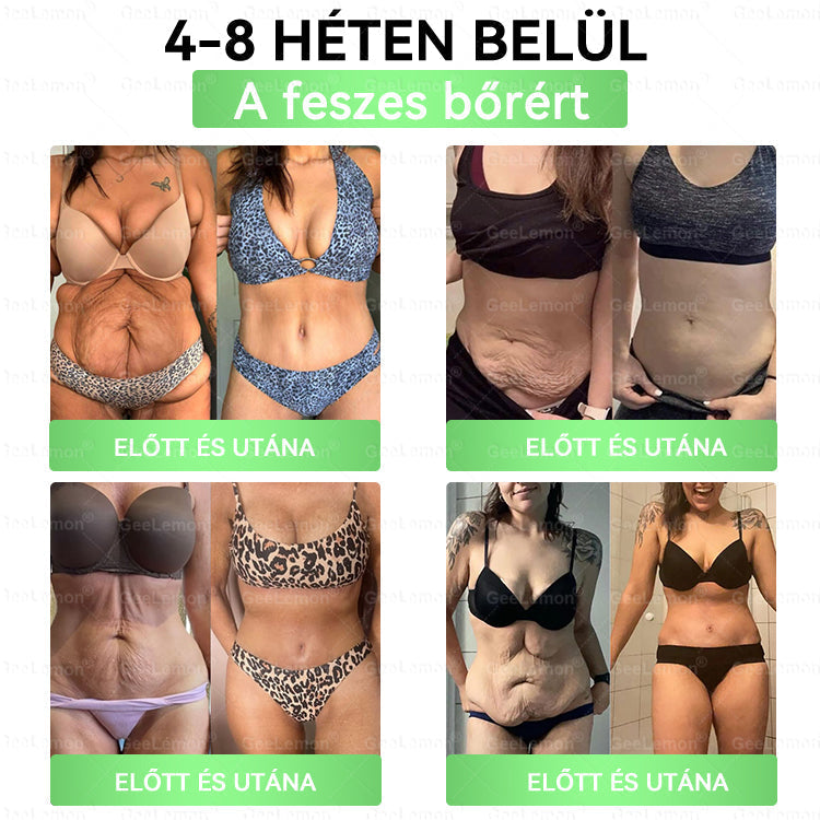 👉 Hivatalos tanúsítás🔥 Több ezer elégedett felhasználó Magyarországon| 💕🥰𝐆𝐞𝑒𝐿𝑒𝐦𝐨𝐧® Glumasetide 8 az 1-ben Karcsú és Egészséges Nano Mikrotűs Tapasz 🇭🇺
